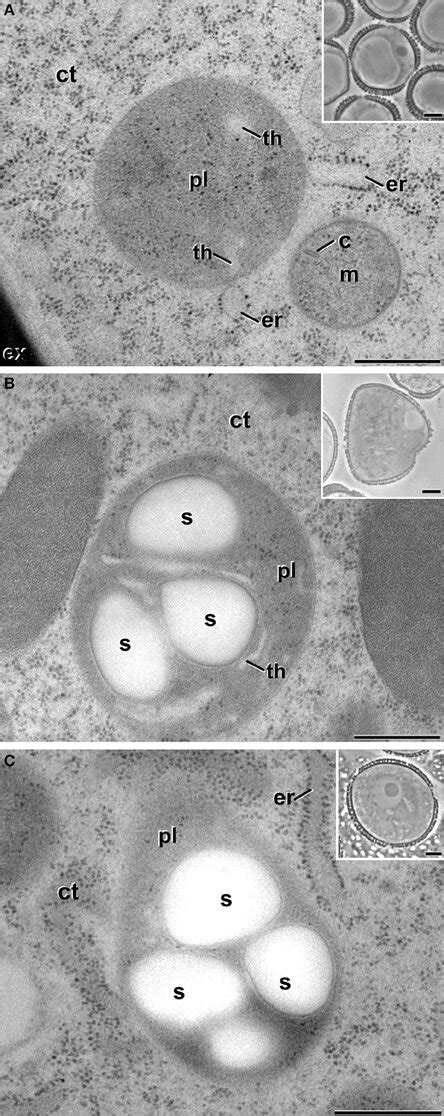 Plastids Pl Of Non Embryogenic B Napus Cells A Proplastid Of A