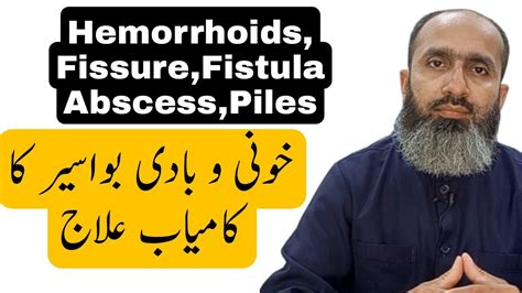 Bawaseer Ka Fori Ilaj How To Get Rid Of Hemorrhoids Piles Bawasir Symptoms Urdu Hindi