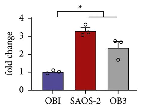 Hotair Expression Was Increased In Os Tissues ∗p Download Scientific Diagram