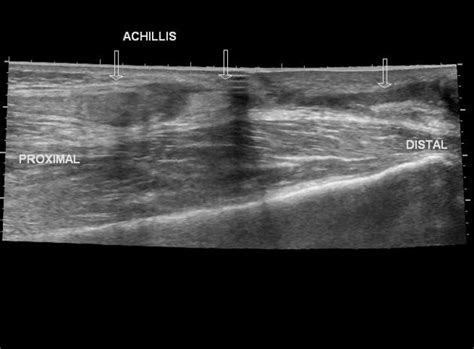 Bozeman Ultrasound Imaging Services Sound Diagnostics