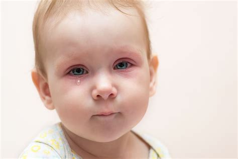 A mi bebé le llora mucho un ojo Tendrá el lacrimal obstruido Lucía