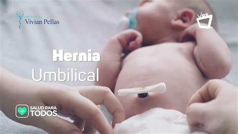 Hernia Umbilical Síntomas Y Causas Salud Para Todos Youtube