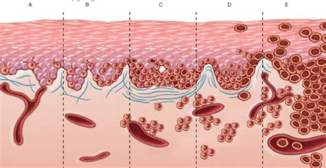 Skin Pathology Flashcards Quizlet