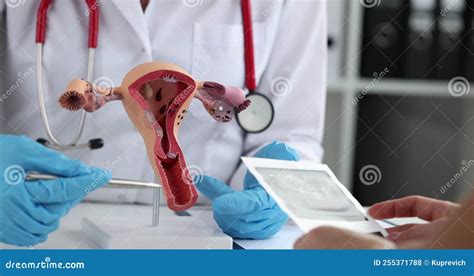 Doctor Shows Anatomical Model Of Uterus With Pathologies Of Patient