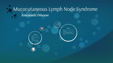 Mucocutaneous Lymph Node Syndrome By Jade Le On Prezi