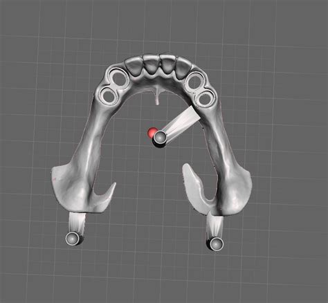 Fichier STL Modèle dentaire avec couronne télescopique Plan