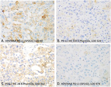 Quantitative Comparison Of Pd L Ihc Assays Against Nist Standard