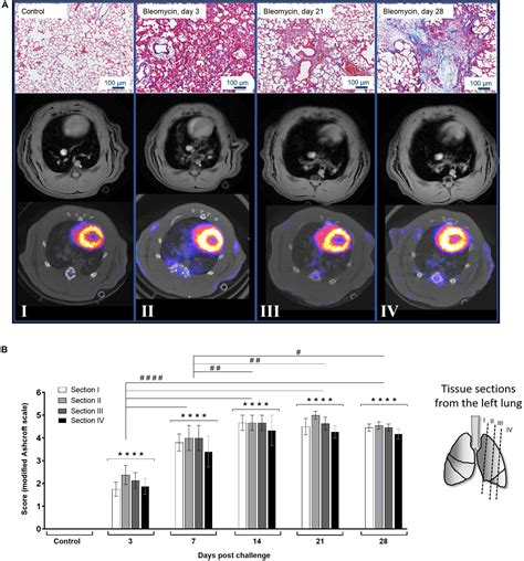 Frontiers Imaging Biomarkers And Pathobiological Profiling In A Rat