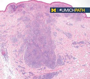 Michigan Pathology On Twitter The Wait Is Over Courtesy Of Dr