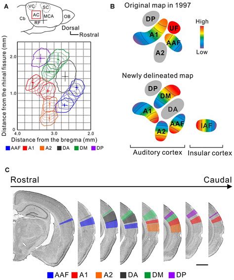 Frontiers Reconsidering Tonotopic Maps In The Auditory Cortex And