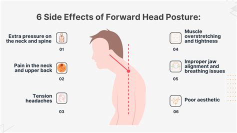 Can A Chiropractor Fix Forward Head Posture