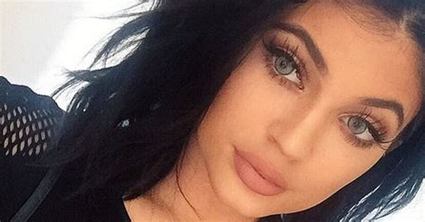 Kylie Jenner Admits Plump Lips Are Due To Fillers But Is The Procedure