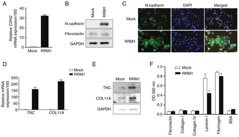 Rrm1 Overexpression Increases The Expression Of Extracellular