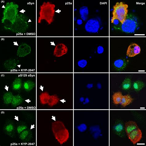 Kyp‐2047 Reduces Cytosolic Immunoreactivity In P25α‐transfected Cells