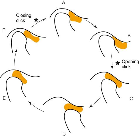 Temporomandibular Joint Disorders Clinical Tree