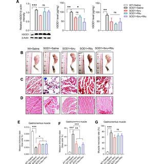 Ibrutinib Rescued Muscle Atrophy In Sod Mice A Representative