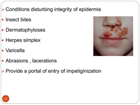 Staphylococcal And Streptococcal Skin Infections Ppt