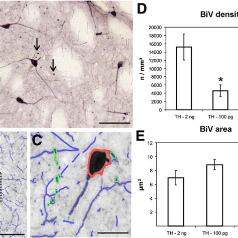 Immunohistochemical staining of the rat CPu for ChAT one month after ... 