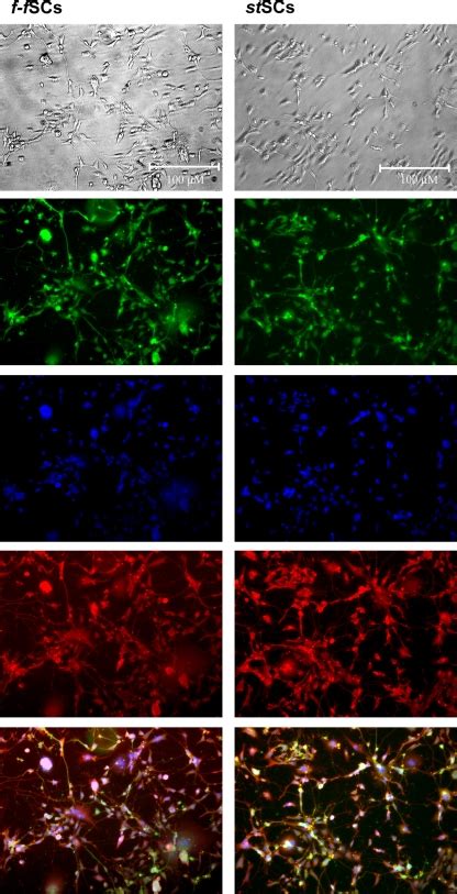 Immunocytochemical Analysis Of Microtubulin Associated Protein 2 Map2