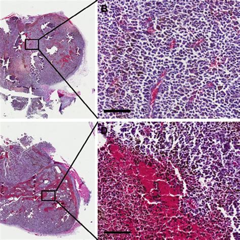 Gross Histologic Examination By Hematoxylin And Eosin Hande Staining