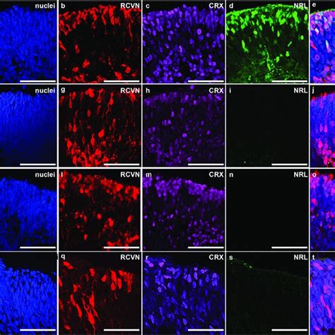 Rho Expression Is Found In L75pfs Organoids Following Viral