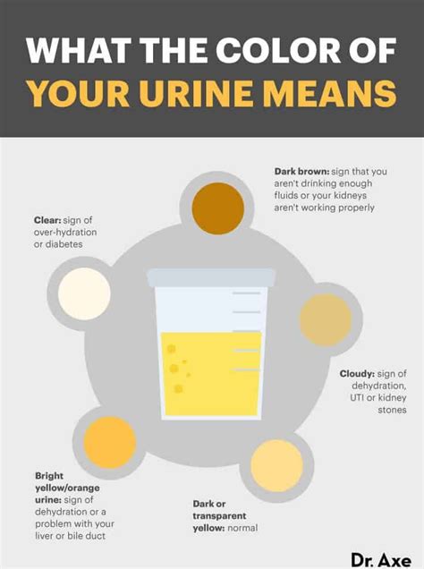 Cloudy Urine Causes Diagnosis And Natural Remedies Dr Axe