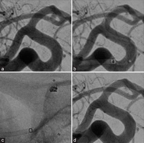 Surgical Neurology International