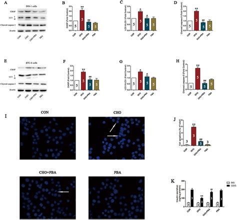 Inhibition Of Er Stress Attenuates Cholesterol Induced Cell Injury