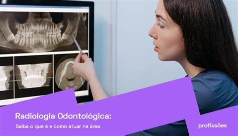 Radiologia Odontol Gica Saiba O Que E Como Atuar Na Rea Descubra