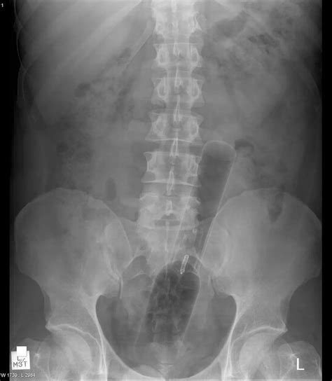 X Rays Of Objects Inside People Mirror Online