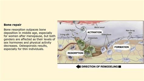 Bone 2 Injury Repair Dr Madden YouTube