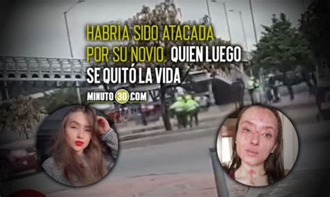 En Video Qu Valiente Joven Que Fue V Ctima De Ataque Con Cido