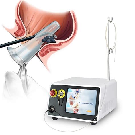 Class Iv Laser 980nm1470nm Multifunctional Anorectal Disease Treatment