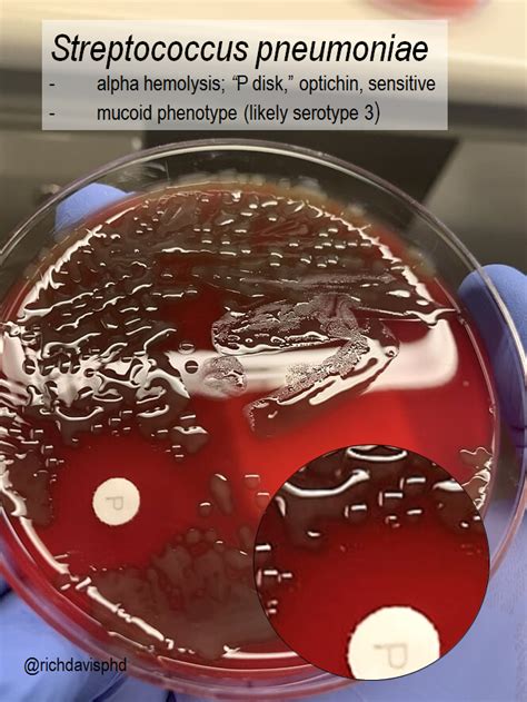 Mucoid Colony