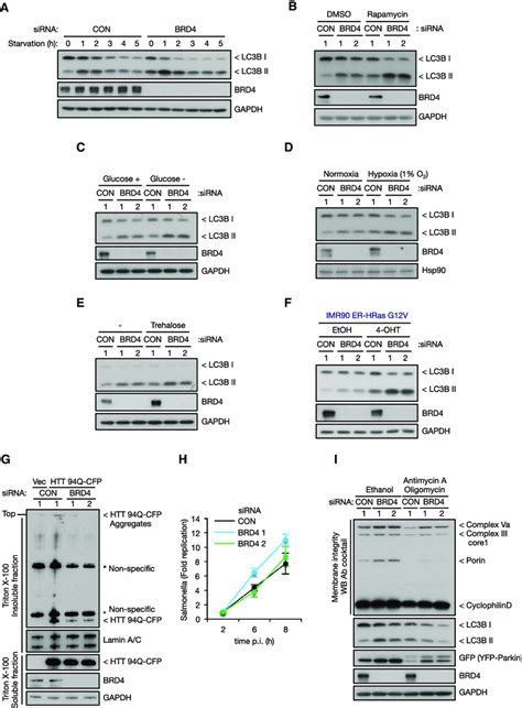 Effect Of Brd4 Silencing On Stimulus Dependent And Selective Autophagy