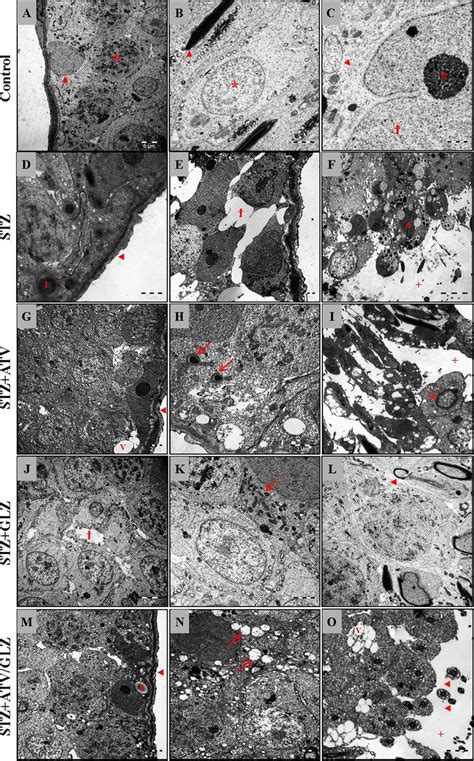 Regular Ultrastructure Of Sertoli Cell Nuclei A Spermatogenic