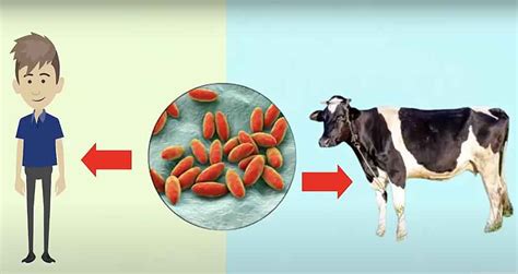 Brucellosis Transmission Symptoms And Treatment A2z Healthy