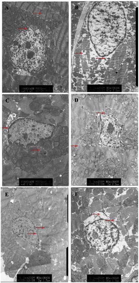 Figure From Effect Of Hydrogen Sulfide On Inflammatory Cytokines In