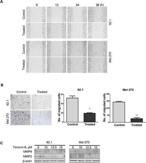 Tenovin Blocks The Migration In Um Cells A Wound Healing Scratch