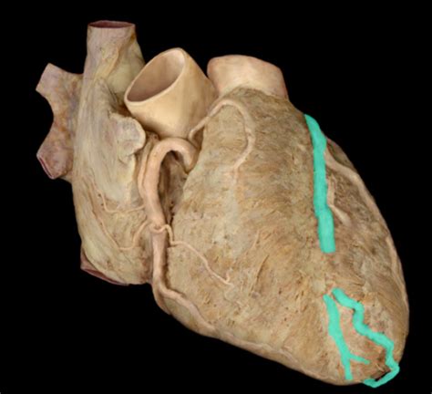 Bms Lab Cardiac Apr Flashcards Quizlet