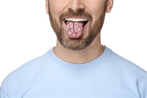dehydrated tongue stock   royalty  stock