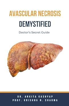 Avascular Necrosis Demystified Doctor S Secret Guide Book