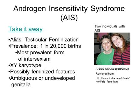 Androgen Insensitivity Syndrome Genitalia