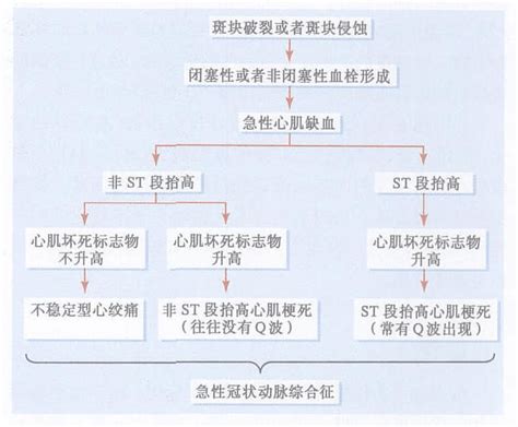 介入心脏病学知识五急性冠状动脉综合征不稳定型心绞痛和非st段抬高性心肌梗死word文档在线阅读与下载无忧文档