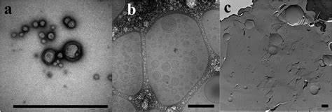 Ns Tem Cryo Tem And Ff Tem Analysis Tem Images Of Pb Peo