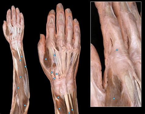 Antebrachium And Hand Posterior View Diagram Quizlet