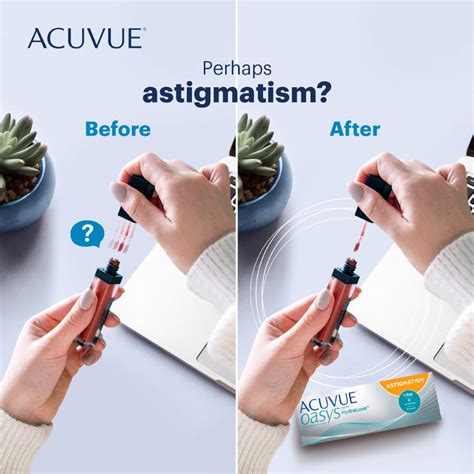 1-Day Acuvue Oasys for Astigmatism with Hydraluxe Technology (30pcs in ...