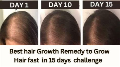 Days Extreme Hair Growth Challenge Extreme Hair Growth Grow Hair