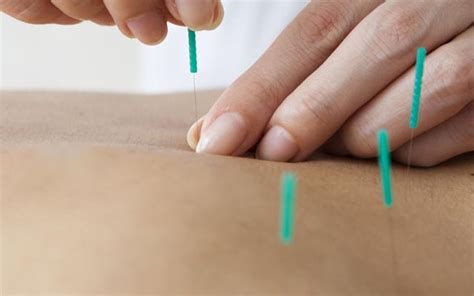 Centro de Fisioterapia Las Rozas Osteopatía INDIBA Nutrición y Más