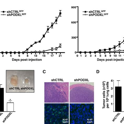 Podocalyxin Promotes Primary Tumor Formation Local Invasion And